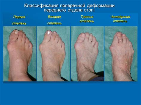 Причины боли в суставах ступни - диагностика и лечение